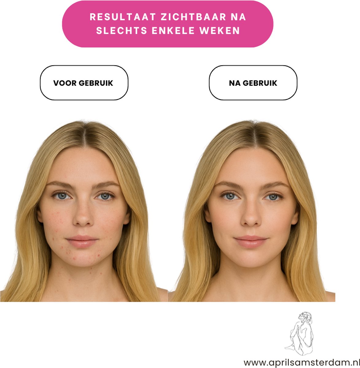 Image of Aprils® Light Therapy - Gezichts- & Nekmasker - Led Masker